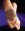Spreizfußbandage Dynamics haut>>>>Gr. 19