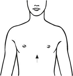 Bort StabiloFix Geradehalter,blau,