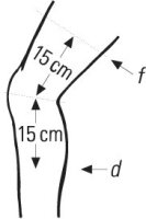 Bort StabiloGen Eco Knie-,Bandage m.HB silber Gr.2+,